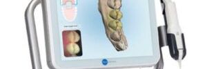 Escáner iTero, Ortodoncia con Experiencia 3D