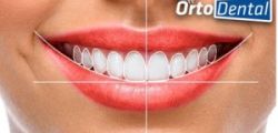 Los Procedimientos Estéticos Dentales para una Bella Sonrisa