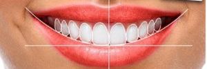 Odontología Estética en México, Sonríe con Confianza y Belleza