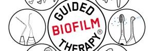 Conoce GBT que Combate el Biofilm en las Limpiezas Dentales