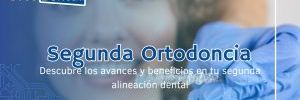 Una Nueva Sonrisa, La Ortodoncia Por Segunda Vez