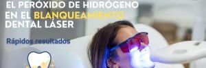Peróxido de Hidrógeno: Cómo Funciona en el Blanqueamiento Denta Láser