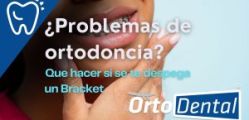 ¿Se Despegó un Bracket? - Guía Para Resolver tus Problemas de Ortodoncia.
