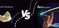 iTero Lumina™ vs Moldes de Ortodoncia