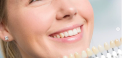 15 Beneficios del Blanqueamiento Dental