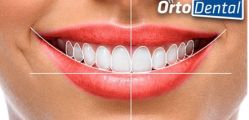 DSD - Inovación en Odontología Estética