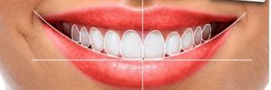 DSD - Inovación en Odontología Estética