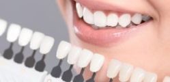 Blanqueamiento Dental y Ortodoncia: La Clave para una Sonrisa Perfecta