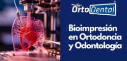 Bioimpresión en Odontología y Ortodoncia