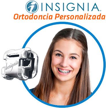 Ortodoncia Insignia en Mexico DF