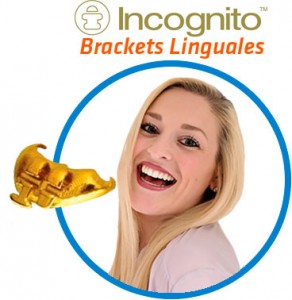 Ortodoncia Lingual Incognito