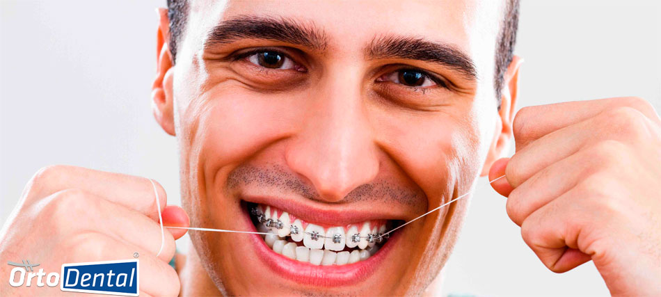 evidencia Paine Gillic Nublado Cómo usar el hilo dental con brackets? | OrtoDental | Ortodoncista en  México DF CDMX