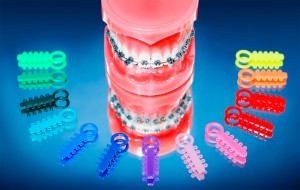 Brackets y ligas de colores