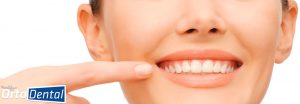 Recidiva Dental Ortodoncia