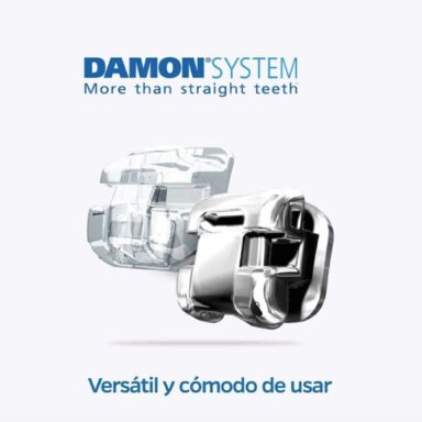 Damon System