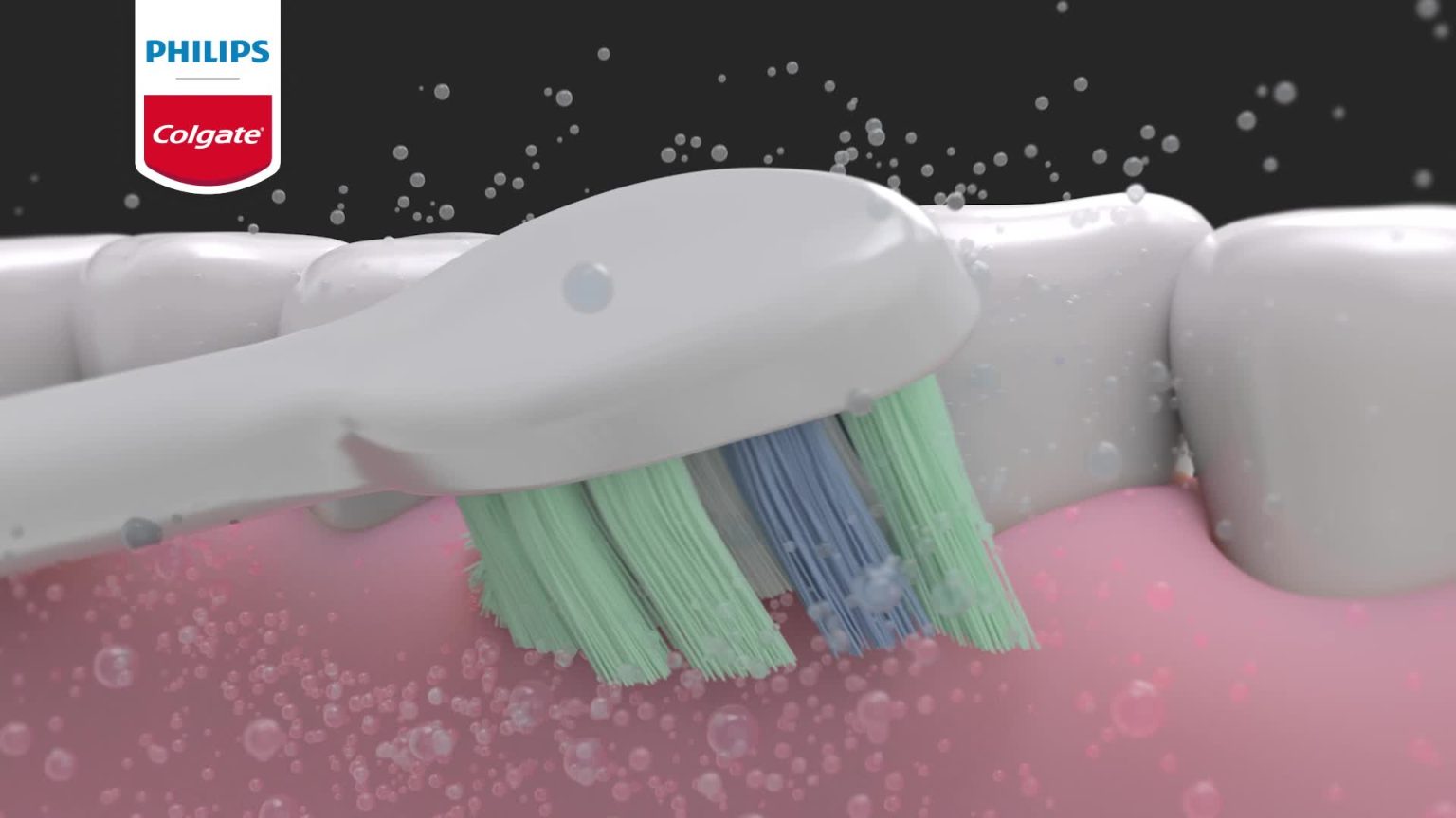 Conoce el Cepillo Colgate SonicPro 30. | OrtoDental | Ortodoncista en ...