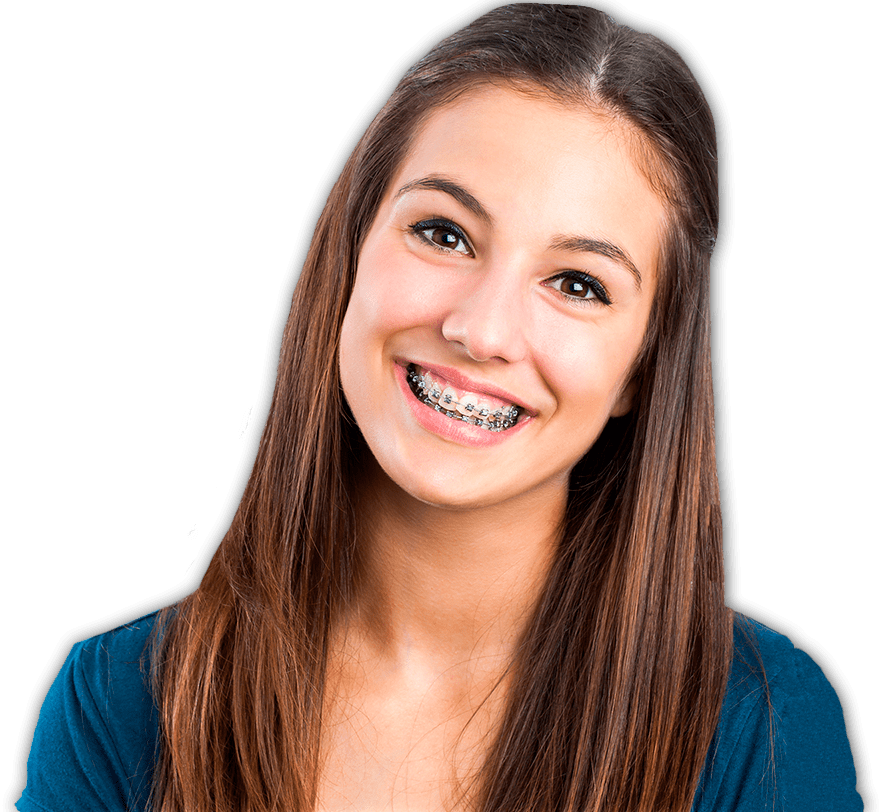 Invisalign: Preguntas frecuentes. - Centro Dental Smiling