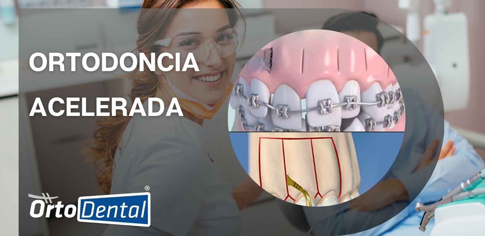 El Hilo Dental y la Importancia de la Higiene Oral Preventiva, OrtoDental, Ortodoncista en México CDMX