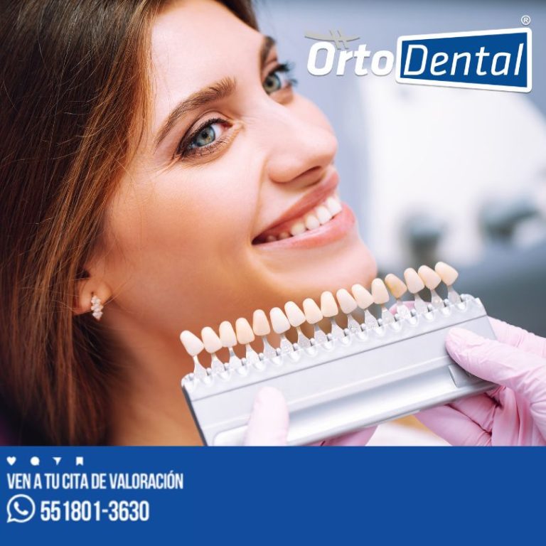 El secreto del blanqueamiento dental láser para la juventud de la