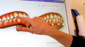 Ortodoncia Moderna