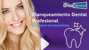 beneficios del blanqueamiento dental profesional