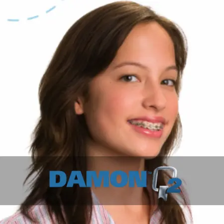 Damon Q2 en México