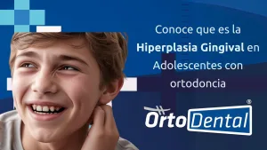 Hiperplasia Gingival