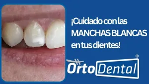 manchas blancas