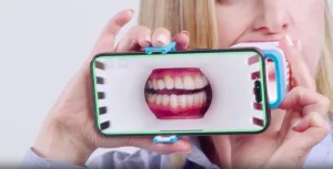 Invisalign Virtual AI APP