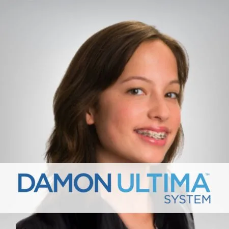 Damon Ultima