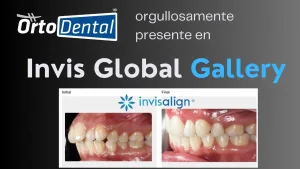 Invis Global Gallery