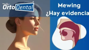 Mewing