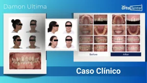 Caso Clínico Damon Ultima