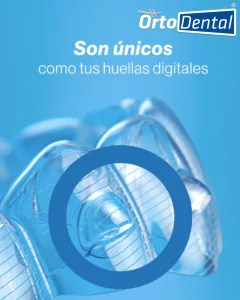 SmartForce