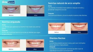 Sonrisa Damon Ultima