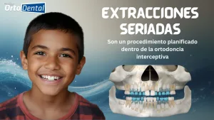 Extracciones seriadas