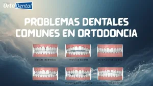 Problemas dentales