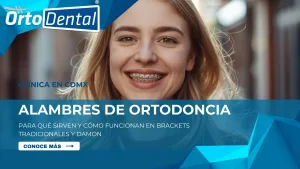 Alambres de ortodoncia