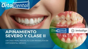 Caso Apiñamiento Severo CII Enero 2026 Banner