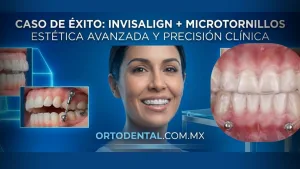 Microtornillos Invisalign
