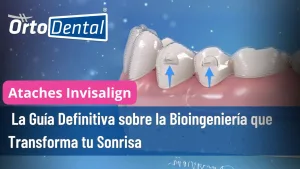 Ataches Invisalign
