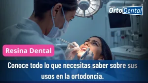 Resina Dental
