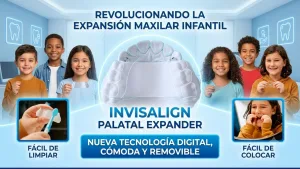 Invisalign Palatal Expander